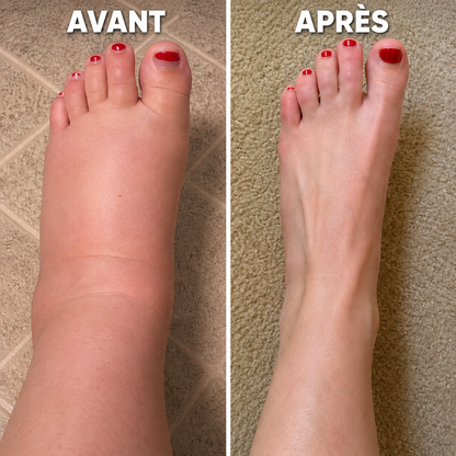 Nervalis Pro - Thérapie du Pied 4-en-1